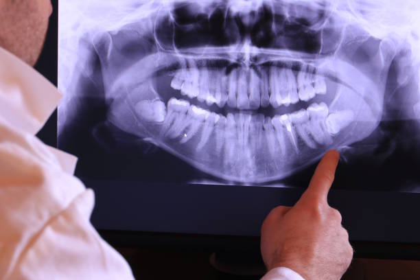 Best Chipped Tooth Repair Near Me  in Bradenton, FL